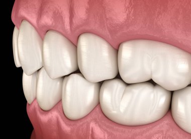 Normal tıkanıklığı olan sağlıklı insan dişleri. Tıbbi olarak doğru diş 3D illüstrasyon