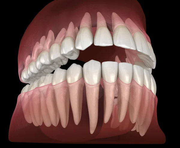 人类牙齿的形态 医学上准确的牙齿3D图像 — 图库照片