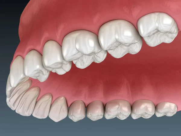 Maxillary human gum and teeth. Medically accurate tooth 3D illustration