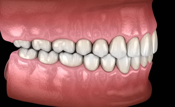 Healthy human teeth with normal occlusion. Medically accurate tooth 3D illustration