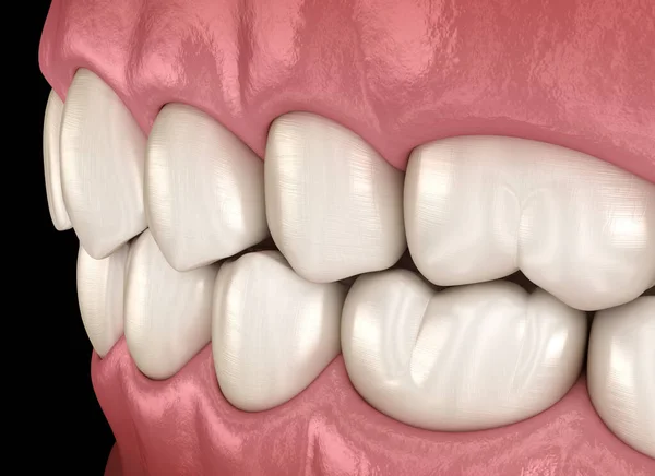 Dentes Humanos Saudáveis Com Oclusão Normal Ilustração Dente Medicamente Precisa — Fotografia de Stock