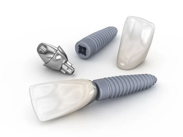 セラミッククラウン カスタムインプラントのアブレーションとインプラント 歯科移植の医学的に正確な3Dイラスト — ストック写真