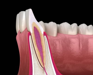 Üst çene yan kesici diş ve sakız anatomisi (enine kesit). Tıbbi olarak doğru olan 3 boyutlu diş illüstrasyonu