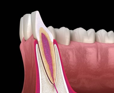 Anatomy of maxillary lateral incisor tooth and gum (cross section). Medically accurate dental 3D illustration clipart
