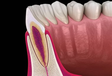 Üst çene yan kesici diş ve sakız anatomisi (enine kesit). Tıbbi olarak doğru olan 3 boyutlu diş illüstrasyonu