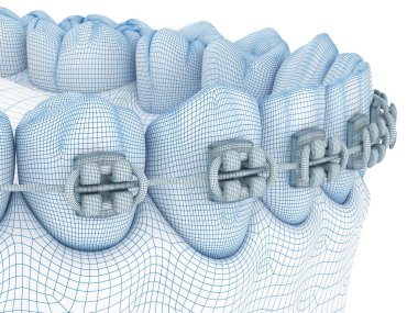 Diş telleri ve takma dişler. Kablo 3d model illüstrasyonu