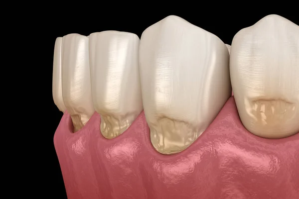 Отклонение Передних Зубов Медицинская Точность Иллюстрации — стоковое фото