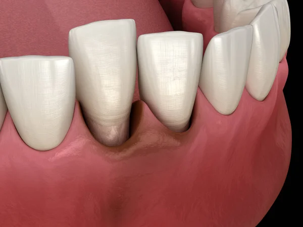 Вывих Зуба После Травмы Медицинская Точность Иллюстрации — стоковое фото
