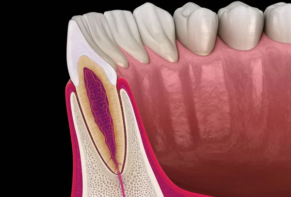 Anatomie Des Kieferseitigen Schneidezahns Und Des Zahnfleisches Querschnitt Medizinisch Korrekte — Stockfoto