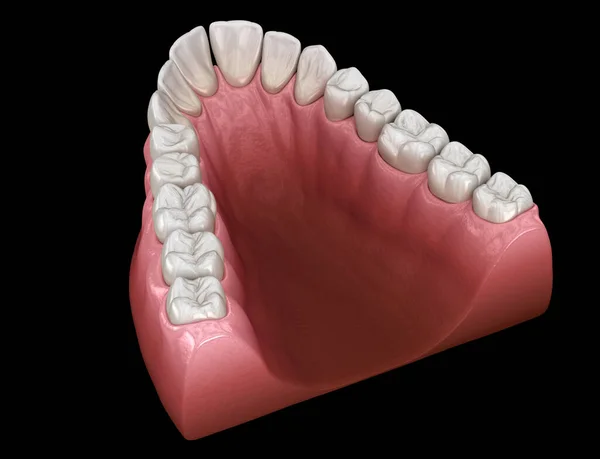 上颌V形锥形拱形 医学上准确的牙齿3D图像 — 图库照片