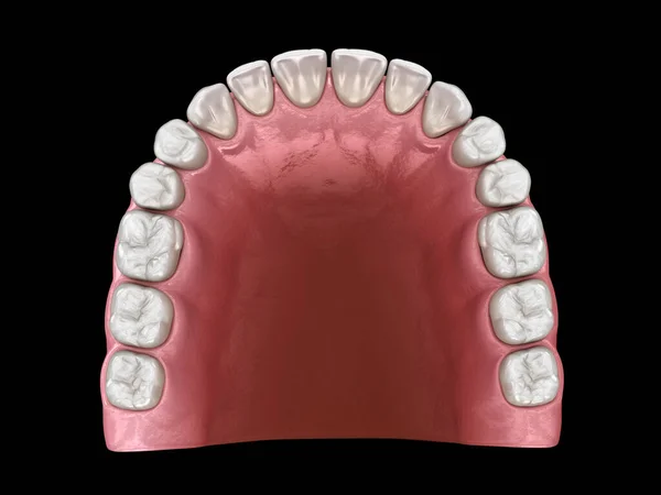 U形卵形拱形上颌骨 医学上准确的牙齿3D图像 — 图库照片