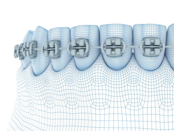 假牙和假牙 线路图3D模型说明 — 图库照片