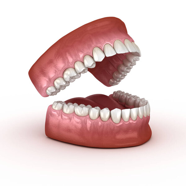 Dental anatomy - Opened Dentures. Medically accurate dental 3D illustration