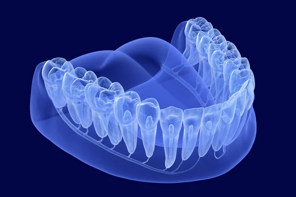 Anatomie Zubů Rentgenový Pohled Lékařsky Přesná Zubní Ilustrace — Stock fotografie
