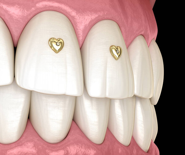 Teeth decoration with jewelry, 3D illustration concept.