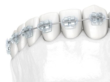 Dişler ve temiz diş telleri. Tıbbi olarak doğru olan 3 boyutlu diş illüstrasyonu