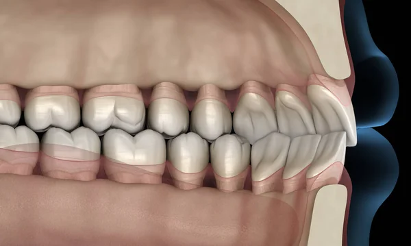 Healthy human teeth with normal occlusion, 3D Illustration