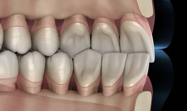 Denti Umani Sani Con Occlusione Normale Illustrazione — Foto Stock