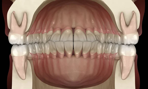 Zdrowe Ludzkie Zęby Normalnym Zamknięciem Ilustracja — Zdjęcie stockowe