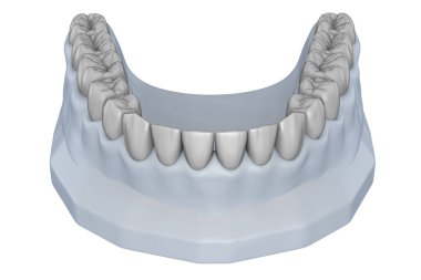 Cilalı diş modeli. Tedavi Planlama. Tıbbi olarak doğru diş 3D illüstrasyon