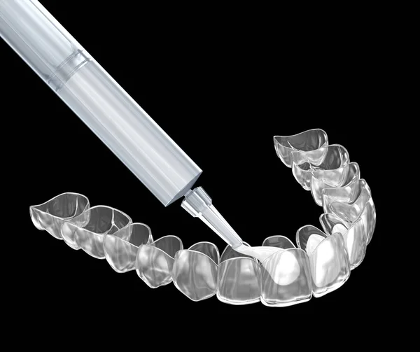 Kit Sbiancamento Dei Denti Aggiungendo Gel Invisalign Concetto Illustrazione — Foto Stock