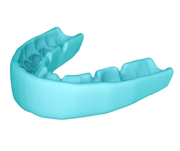 Οδοντιατρικό Κλειδί Σχεδιασμός Θεραπείας Ιατρικά Ακριβές Δόντι Εικονογράφηση — Φωτογραφία Αρχείου