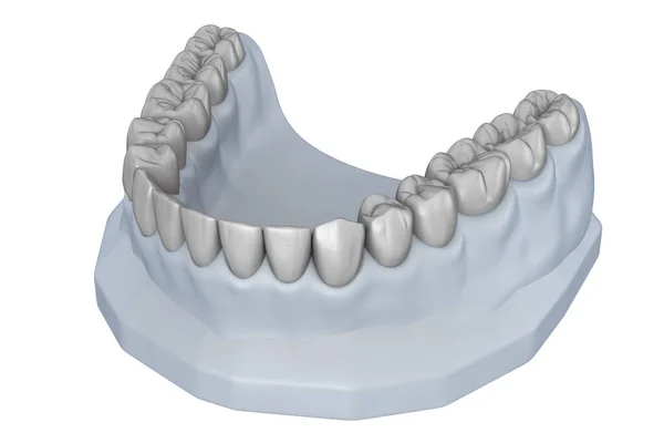 Modelo Dientes Encerados Planificación Del Tratamiento Ilustración Dientes Médicamente Precisos — Foto de Stock