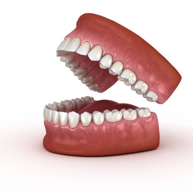 Diş anatomisi - Açık Protezler. Tıbbi olarak doğru diş 3d illüstrasyon