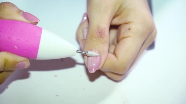 一个长着丑陋指甲的女孩用特殊的机器把指甲上的指甲油取出来准备修指甲 — 图库视频影像