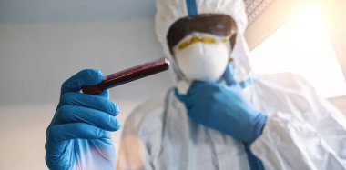 Medic in protective clothing with blood sample for Covid-19 test for antibodies in the laboratory