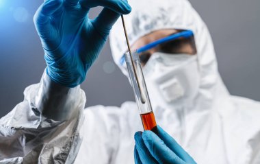 Corona COVID-19 'u hastanede tutan tıbbi ya da bilimsel testler. Korona virüsü Avrupa, İtalya, Wuhan, Çin. Salgın ve Salgın Enfeksiyon 
