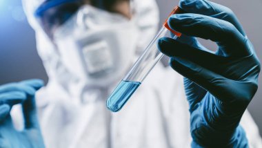2019-nCoV Coronavirus test tüpüne bakan kadın tıp araştırmacısı ya da kadın doktor. Kan örneği pozitif. Coronavirüs salgını