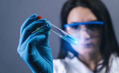 2019-nCoV Coronavirus test tüpü tutan kadın bir laboratuvar çalışanı. Bilim adamının elinde pozitif kan örneği var. Coronavirüs salgını