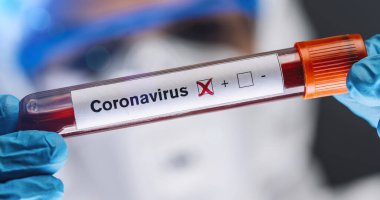 Coronavirus COVID 19 Enfekte Kan Numunesi Doktor 'un Ellerinde. Salgın ve Virüs Salgını.