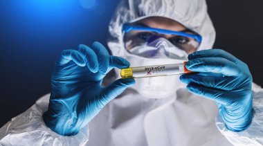 Laboratuvardaki kan örneğinde Covid-19 veya Coronavirus testi pozitif çıktı.