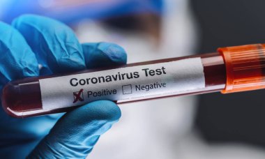 Coronavirus veya covid-19 için pozitif kan testi sonuçları tutan koruyucu giysili doktor ya da hemşire.