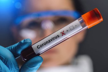 Coronavirus 2019 nCoV kan örneği. Corona virüsü salgını. Laboratuvardaki Corona Virüsü. Bilim adamlarının elinde virüsle kan testi yapılan bir tüp var. Salgın Corona Virüsü