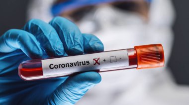 Coronavirus veya covid-19 için pozitif kan testi sonuçları tutan koruyucu giysili doktor ya da hemşire..