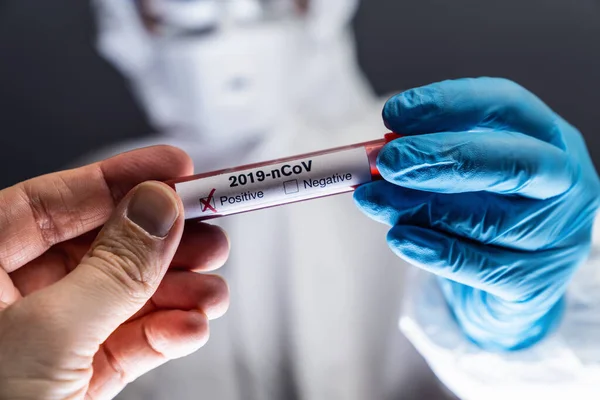 Prueba Coronavirus 2019 Ncov Hand Positivo Análisis Sangre Científico Brote — Foto de Stock