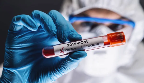 Coronavirus 2019 Ncov Blood Sample Вибух Корони Corona Virus Lab — стокове фото