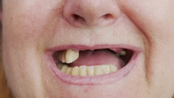 Close-up tandeloze mond van een vrouw. — Stockvideo