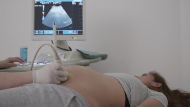 Gravid kvinna tittar på procedur ultraljud skanna av barnet. Undersökning av barnet vid ultraljud. — Stockvideo