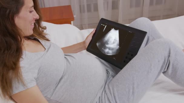 Mutlu bir kadın ultrason sonuçlarını izliyor. İnternetten ultrason fotoğrafı çekiyor. Akıllı telefon kullanarak hamileliği paylaşıyor.. — Stok video