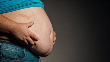 Elleri karnına dokunan bir kişinin aşırı kilolu vücudu. Obezite kavramı.