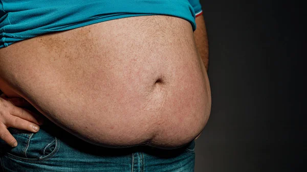 Egy Ember Testének Túlsúlya Akinek Kezei Megérintik Hasát Elhízás Fogalma — Stock Fotó