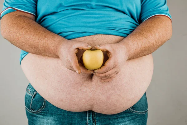 Gordo Tem Uma Maçã Frente Estômago Conceito Dieta Alimentação Saudável — Fotografia de Stock