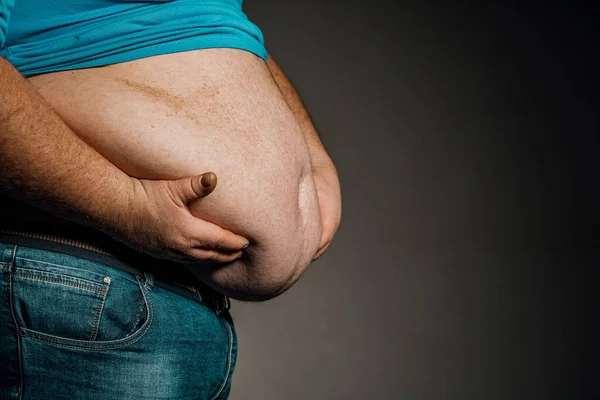 Elleri Karnına Dokunan Bir Kişinin Aşırı Kilolu Vücudu Obezite Kavramı — Stok fotoğraf