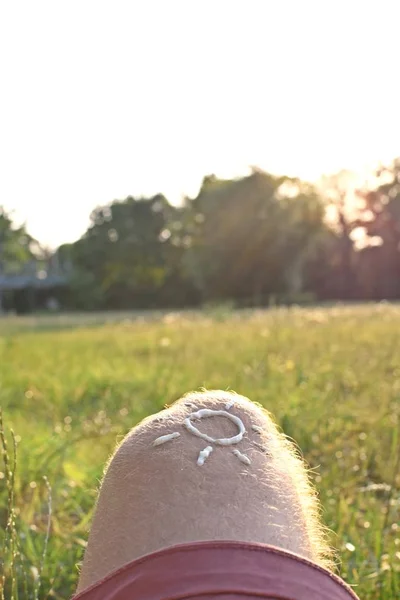 Concept Voor Bescherming Tegen Zon Hete Stranddagen Met Een Mannelijke — Stockfoto