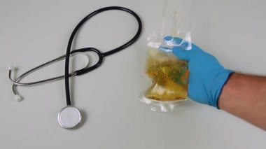 Mavi eldivenli bir doktorun eli steteskopun yanındaki hastane masasına idrar dolu kateter drenaj torbası yerleştiriyor.