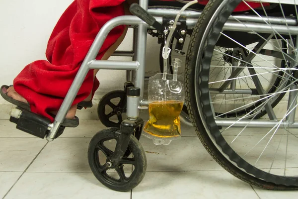 Zblízka Zdravotně Postižená Osoba Invalidním Vozíku Nemocnici Nebo Klinice Které — Stock fotografie